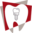 dental implants icon